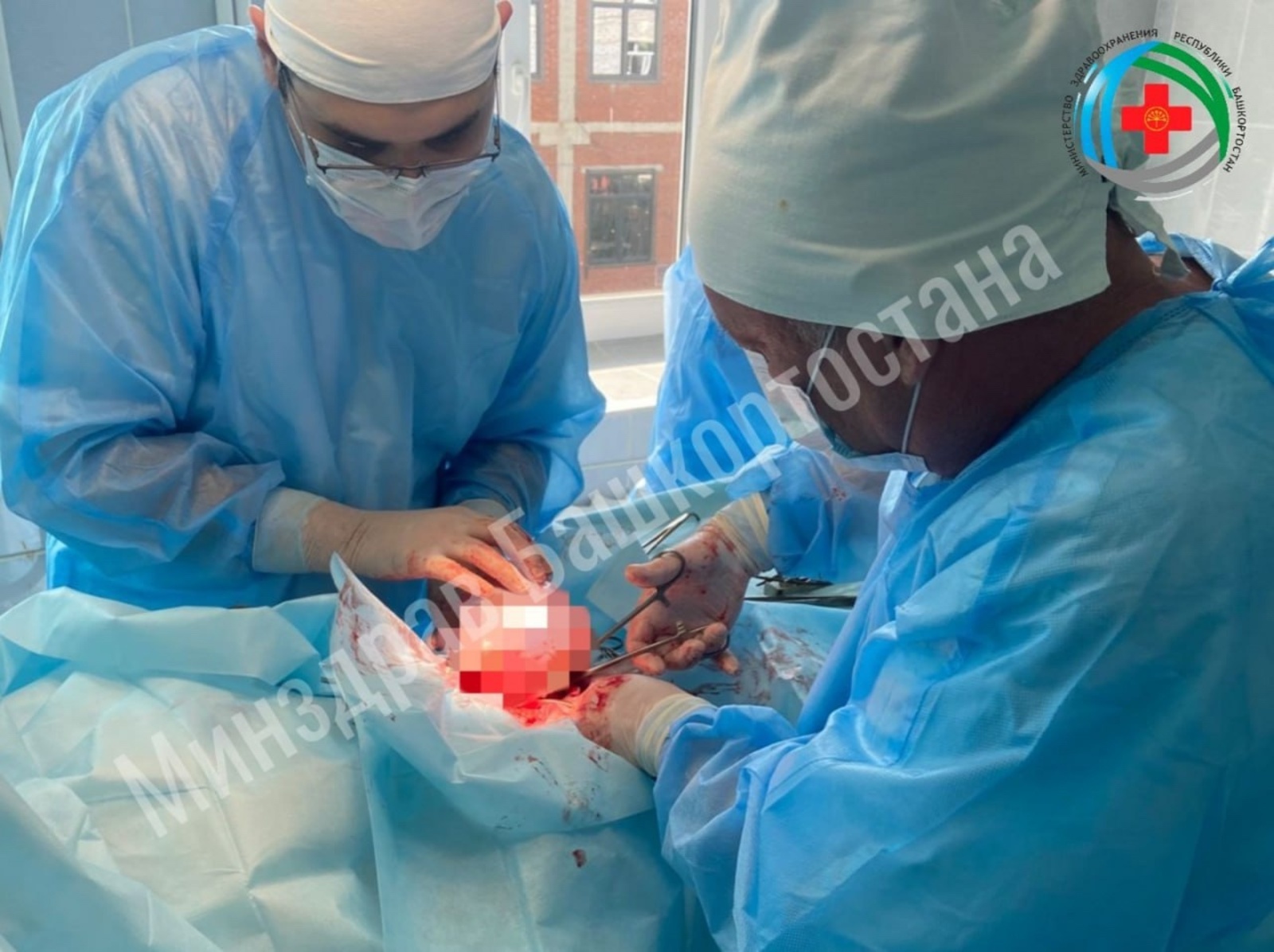 В Башкирии врачи удалили у женщины огромную кисту