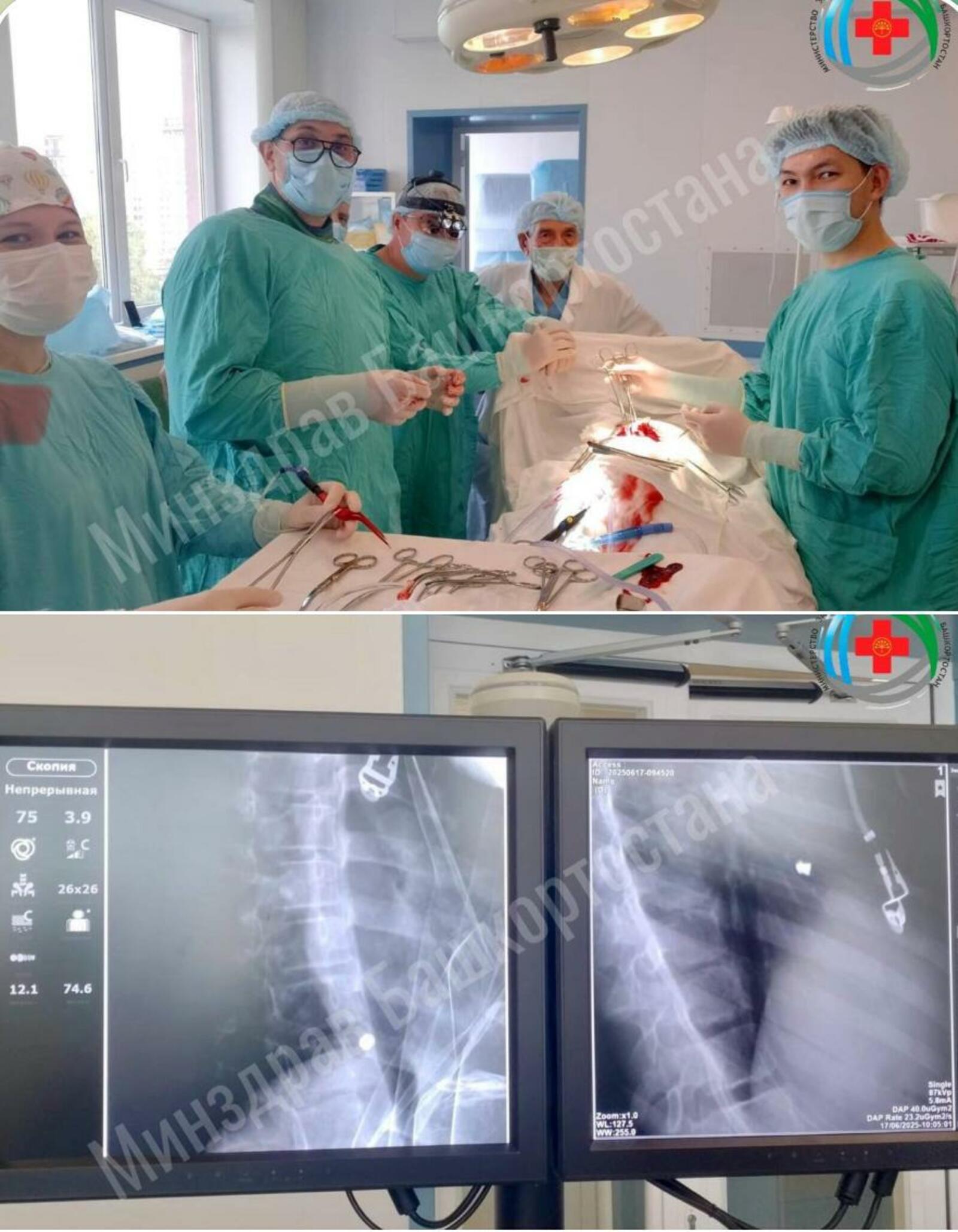 Врачи Башкирии спасли девочку, получившую пулевое ранение сердца