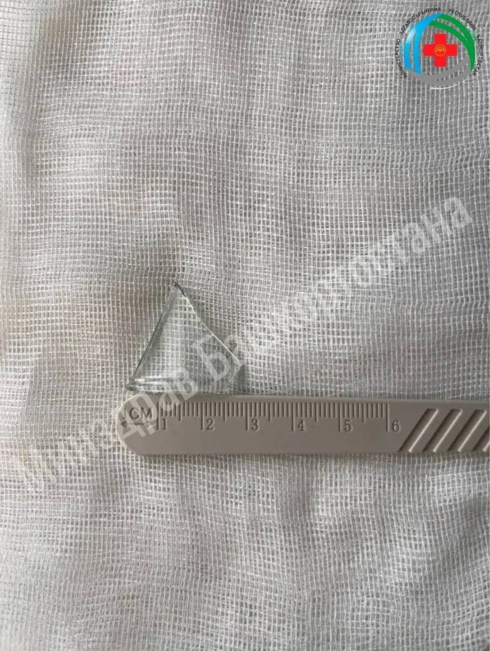 В Уфе мужчина проглотил стекло